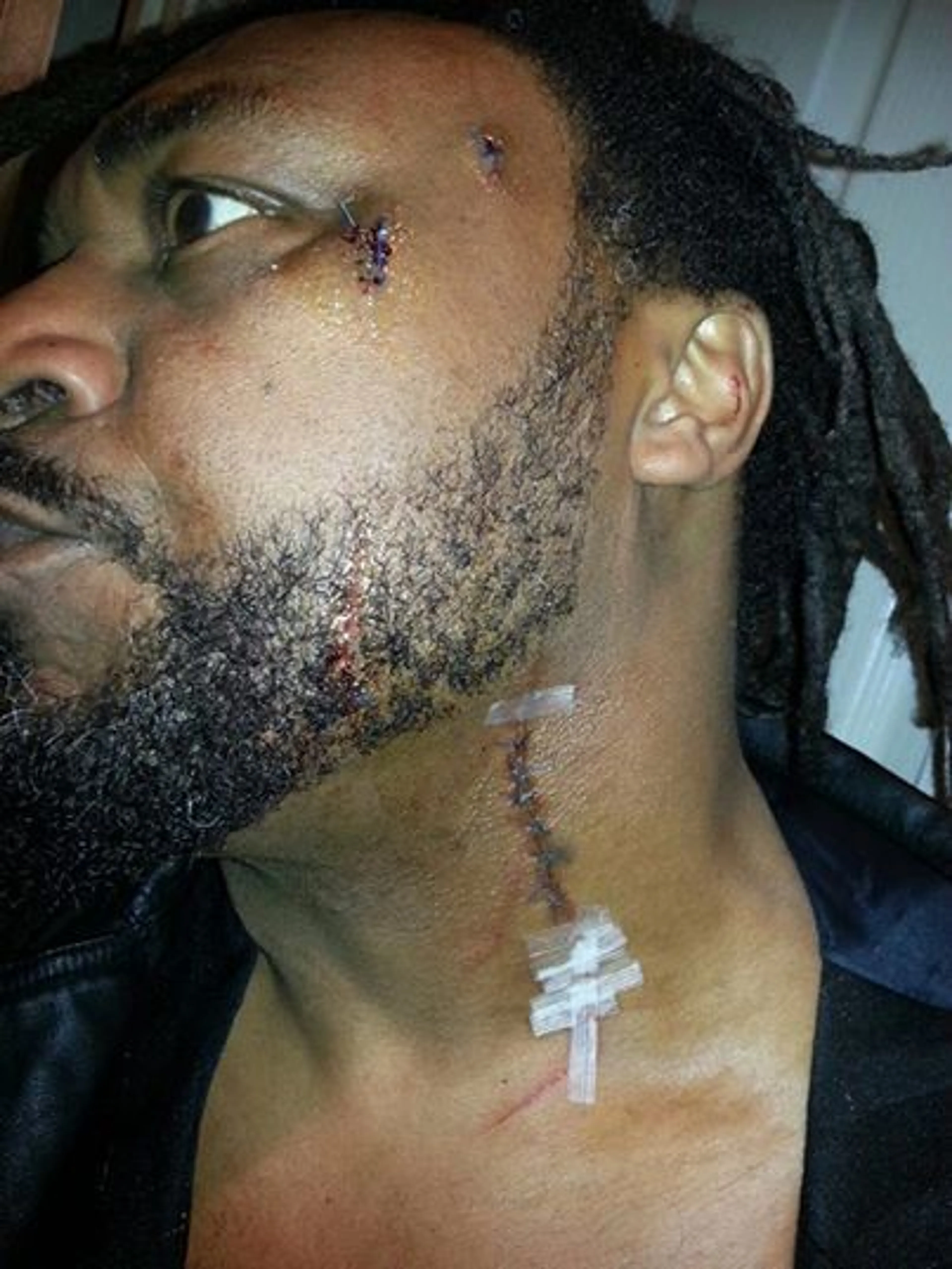 Two Women Arrested Following Attack On Skindred Frontman