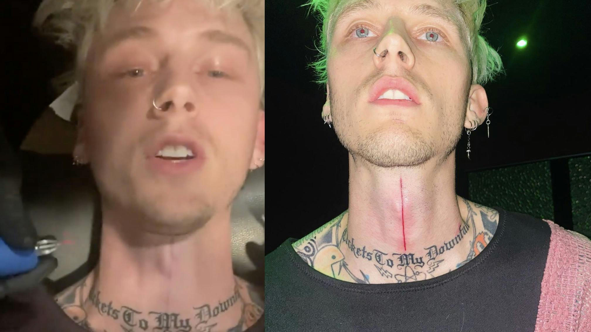 Machine Gun Kelly shares photos of gory-looking new neck tattoo