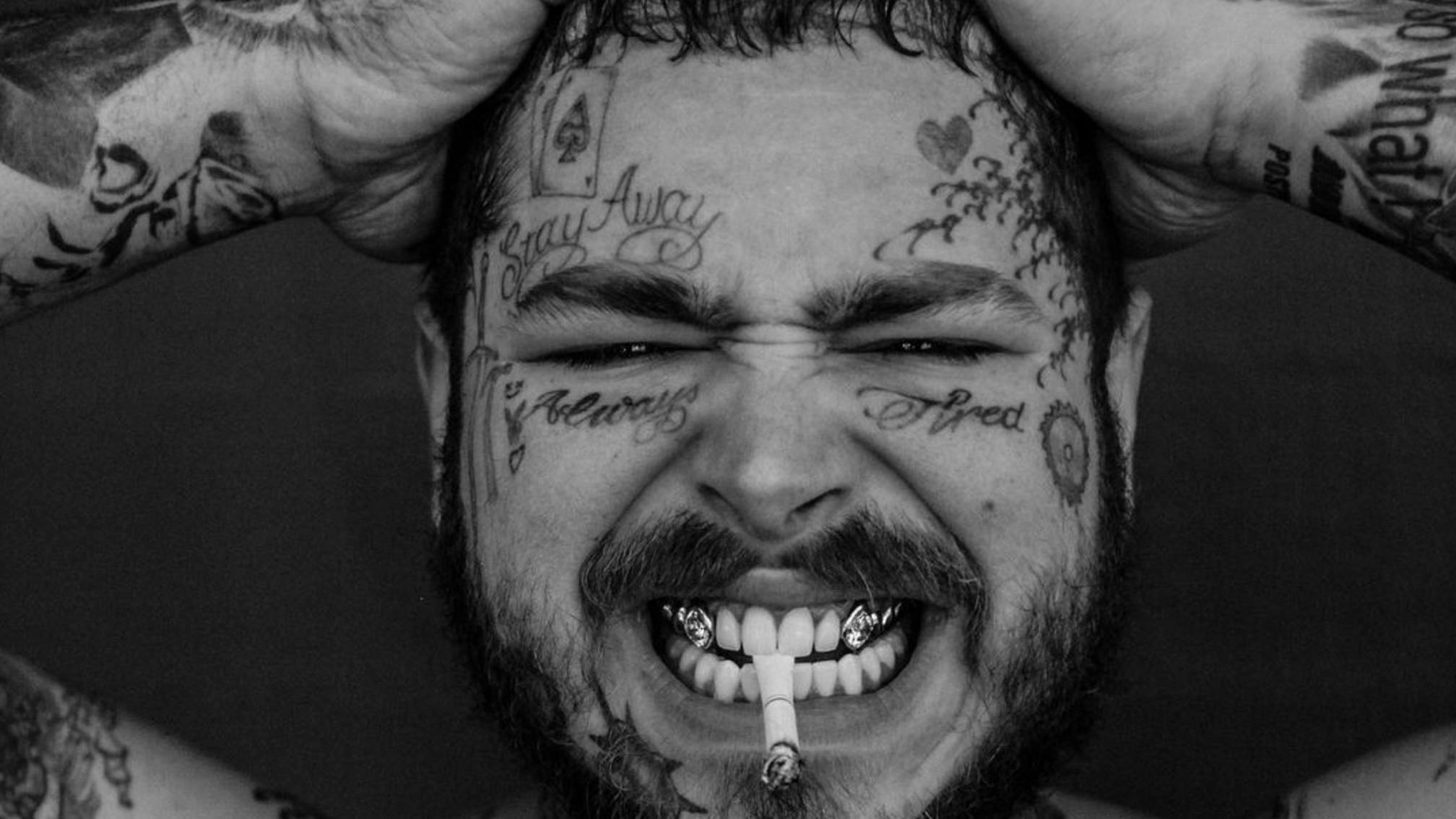 Post Malone spends $1.6million to get real diamond fangs