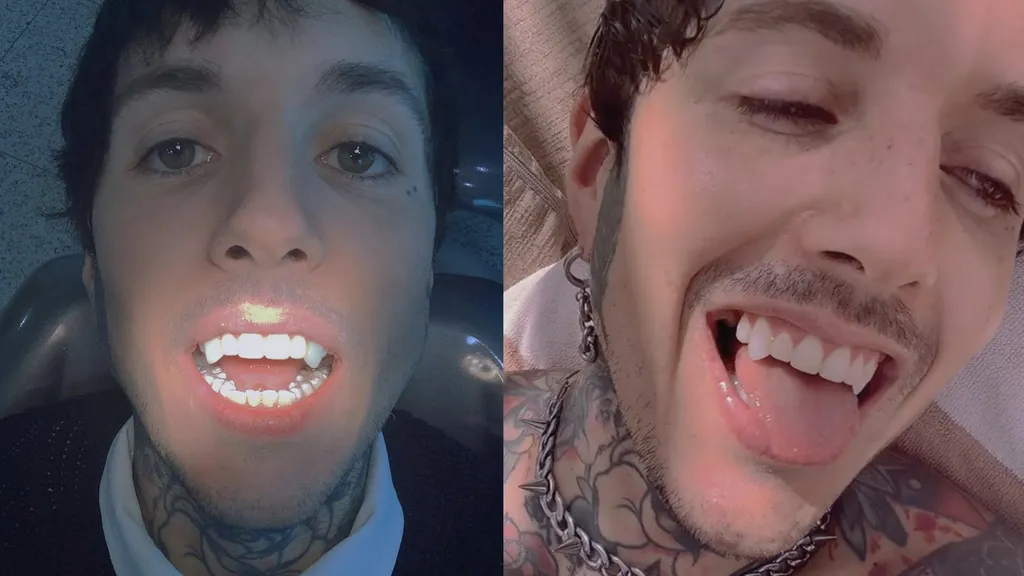 Oli Sykes vampire fangs teeth header Instagram Tik Tok Kerrang