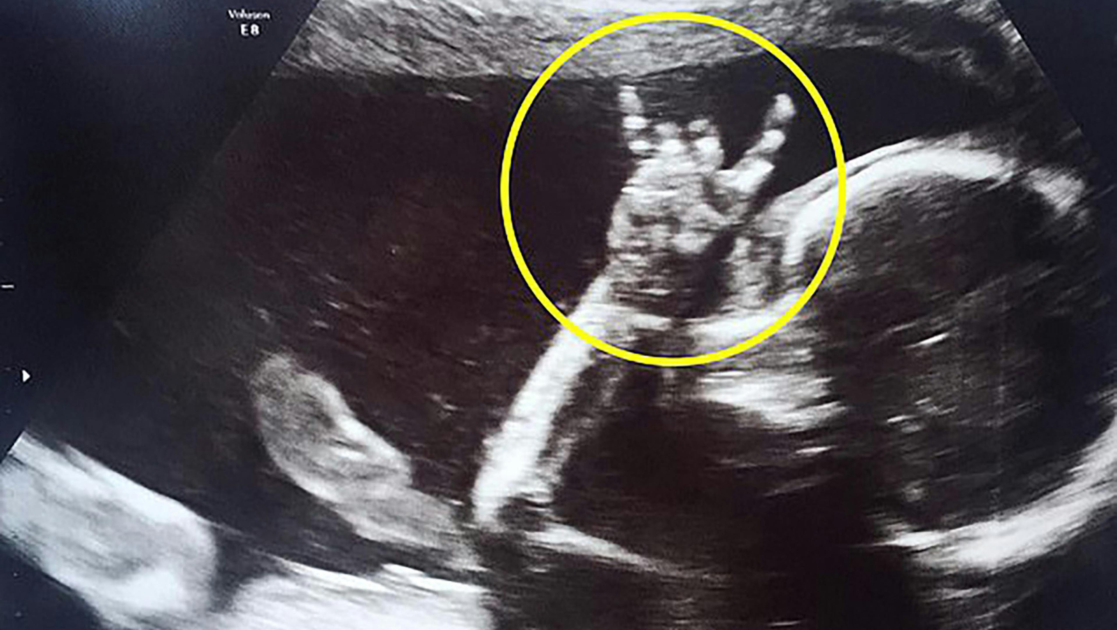 Metal AF Baby Throws Horns In The Womb