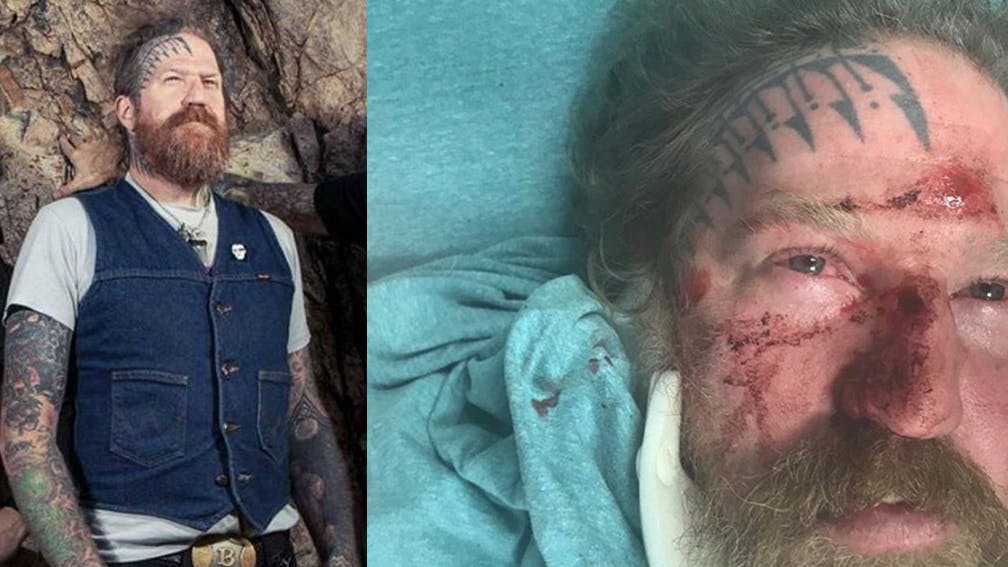 Mastodon's Brent Hinds Shares Pictures From Brutal Hit-And-Run Incident