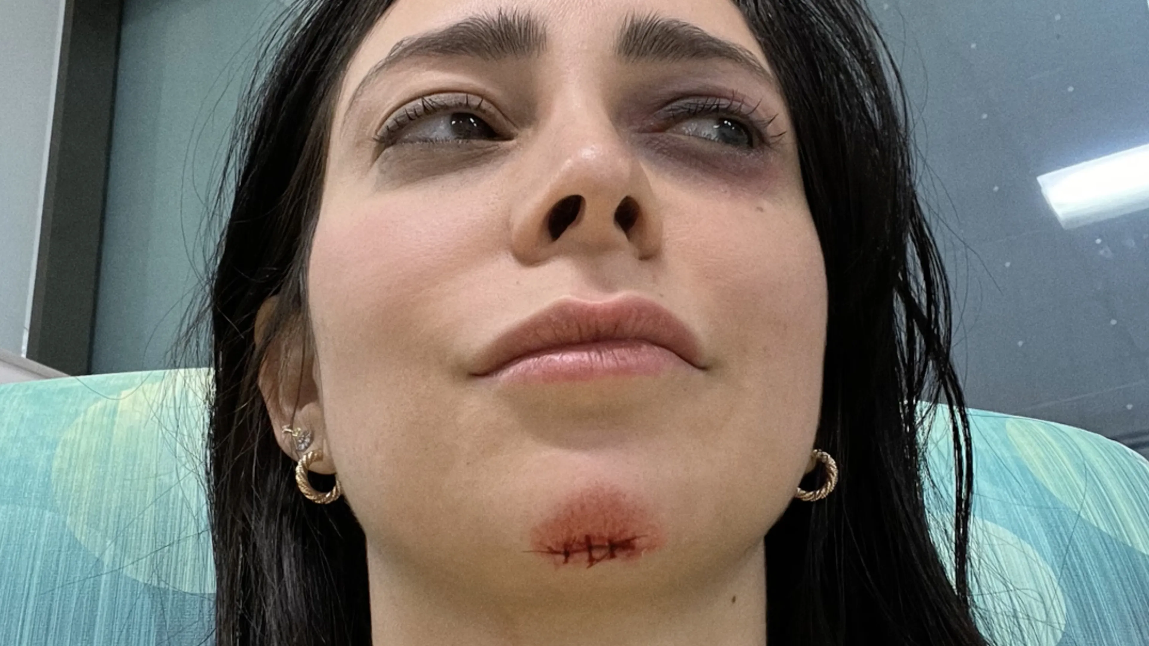 LØLØ releases new single faceplant… and its meaning is painfully literal