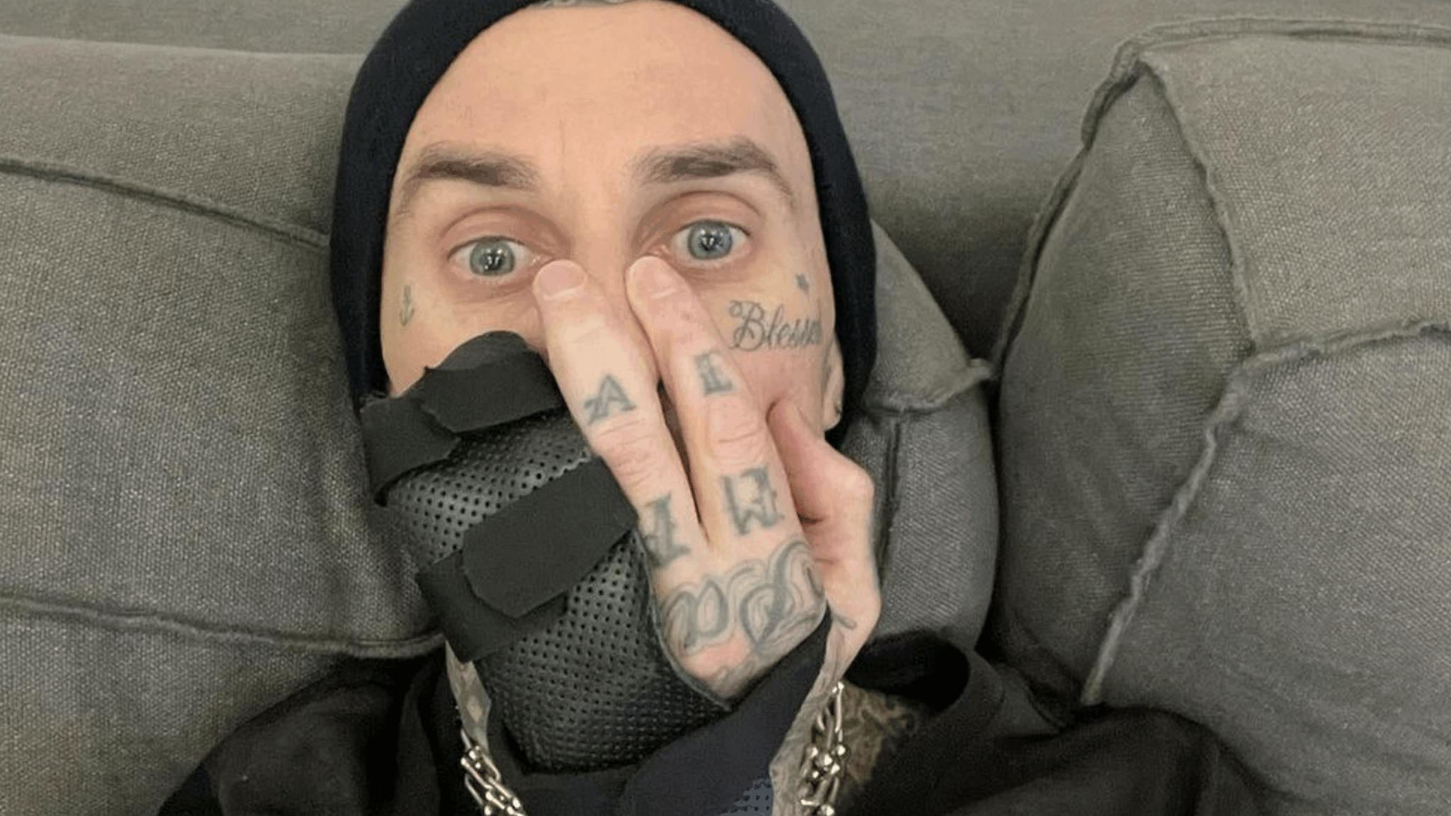 Travis Barker getting surgery on injured finger ahead of blink-182 tour